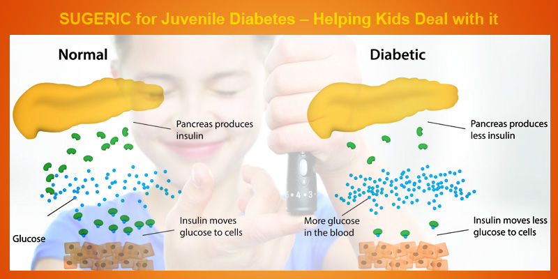 Sugeric for Juvenile Diabetes control organically