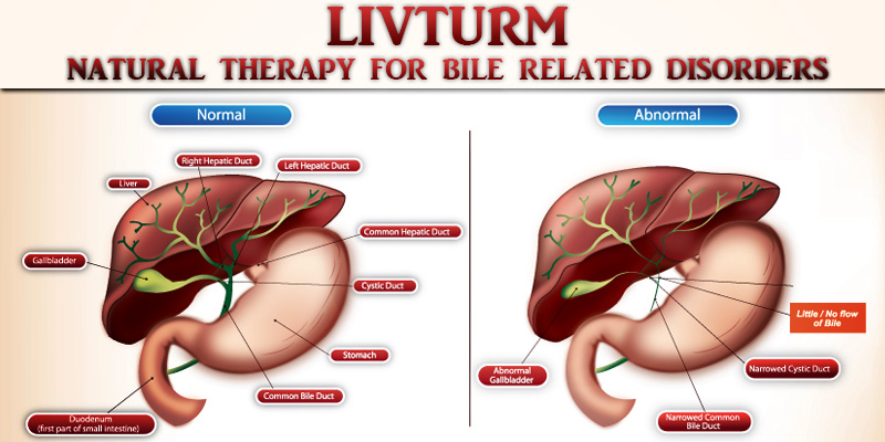Bile disorders livturm is the solution