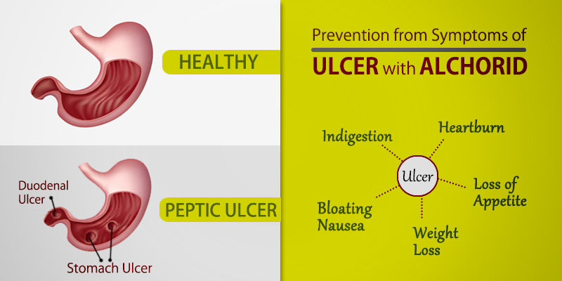 Alchorid an organic way to fight ulcers