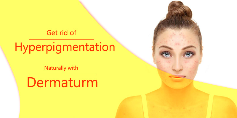 Dermaturm to Treat Hyper pigmentation naturally