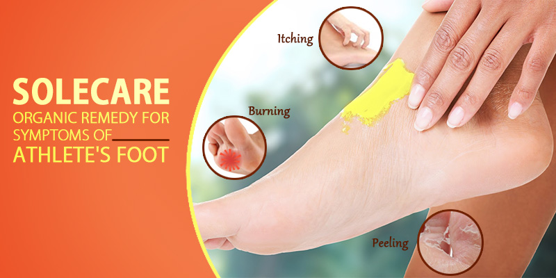 Solecare treats Athlete’s foot naturally