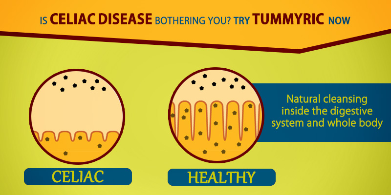 Tummyric helps in celiac disease naturally