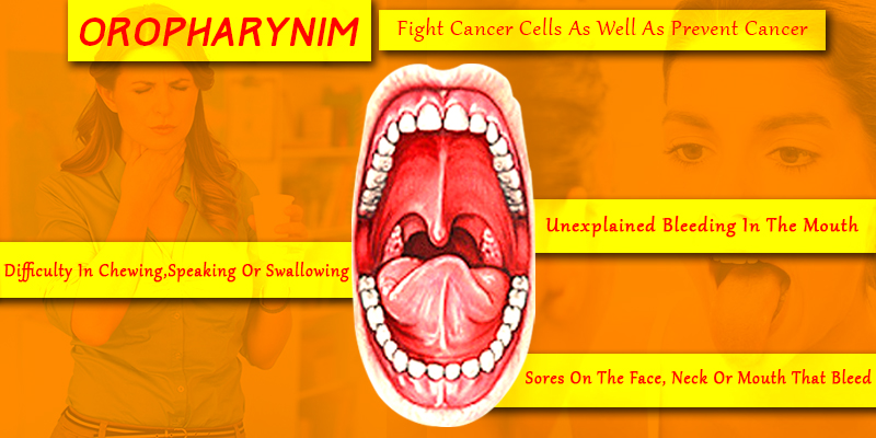 Orophayrnim To Cure Oral Cancer